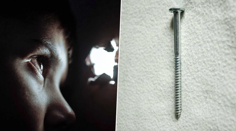 Screw Pierces Three-Year-Old Boy's Eye in Thailand, Miraculously Avoids Getting Blinded