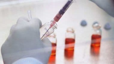 COVID-19 Vaccine Update: Russia to Begin Coronavirus Vaccine 'Sputnik V' Production Within 2 Weeks