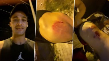 Asim Riaz Attacked By Unidentified Men, Sustains Injuries On Shoulder, Calf and Thighs (Watch Video)