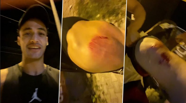 Asim Riaz Attacked By Unknown Assailants