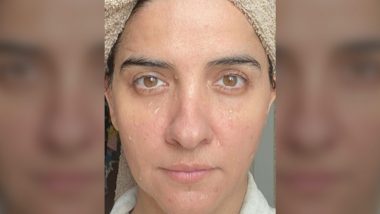 Shruti Seth Shares Extreme Close-Up Selfie Without Make-Up, Says ‘Eat Clean, Hydrate, Repeat’