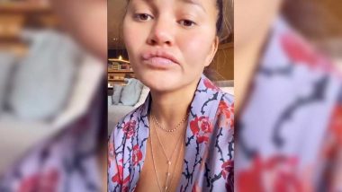 Pregnant Chrissy Teigen Jokes About Eating Too Much Sour Candy At Night