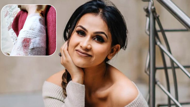 Mujhse Shaadi Karoge Winner Aanchal Khurana Meets With An Accident; Advised 15 Days Bed Rest (Watch Video)