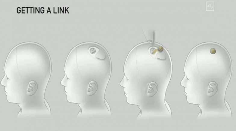 Here's How Elon Musk's Neuralink's AI Technology Could Benefit Humans in Future