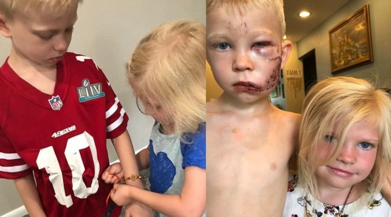 Bridger Walker Who Saved His Sister From Dog Attack Celebrate Raksha Bandhan (View Pic) 