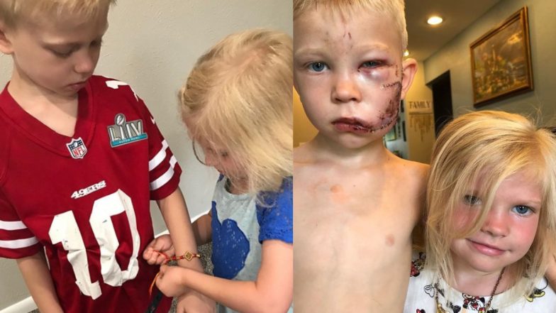 Remember Bridger Walker Who Saved His Little Sister From Dog Attack? Brother-Sister Duo From US Celebrated Raksha Bandhan! (View Pic)