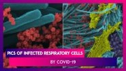 Scientists Publish Images Of Infected Respiratory Cells By Coronavirus; Researchers Show The Intensity Of COVID-19 Infections With New Pictures