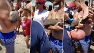 Baby Shark Latches Onto Man&rsquo;s Arm at Jensen Beach in Florida and Refuses to Leave (Watch Video)