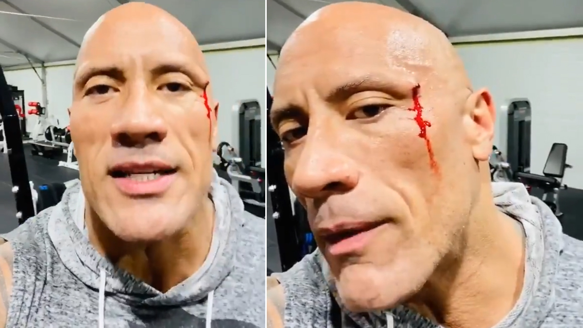 Agency News, Dwayne Johnson AKA The Rock Suffers Face Injury During  Workout (Watch Video)