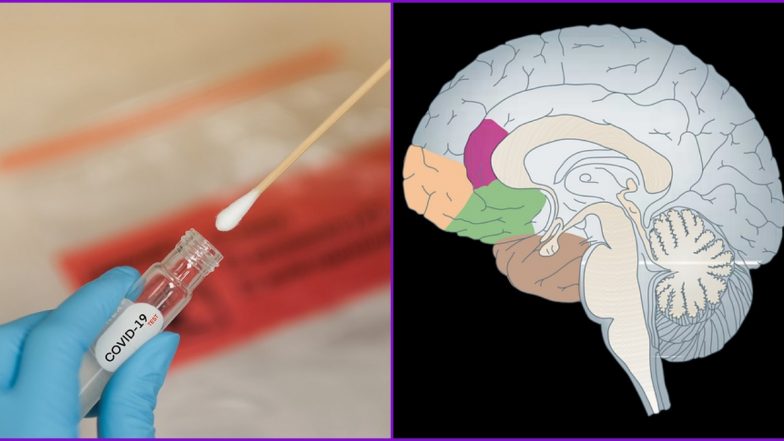 Nasal Swab Test For COVID-19 Results in Brain Fluid Leak in US Woman Suffering From Rare Condition, Report Gives Warning of Caution to Healthcare Professionals
