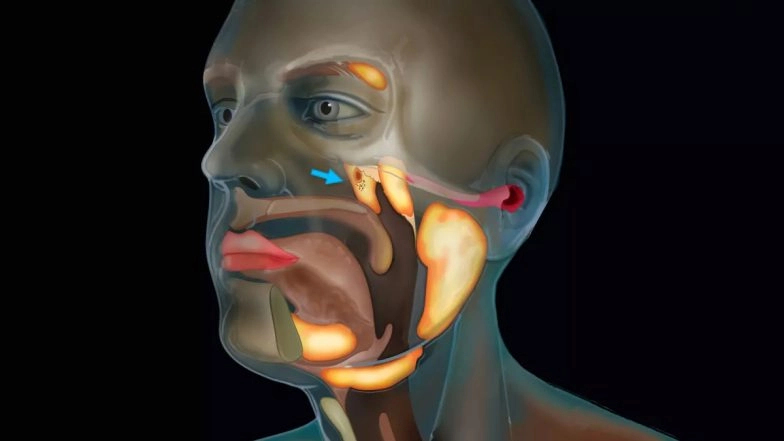 Dutch Scientists Discover New Organ in the Human Throat While Studying Prostate Cancer