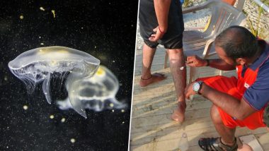 Jellyfish Swarms Invade Goa Beaches: Baga, Calangute, Candolim and Sinquerim Beach Belts Report Over 90 Cases of Stings From Marine Animals