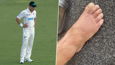 Neil Wagner Bowls Despite Fractured Toe Against Pakistan, Claims Two Wickets on Day 3
