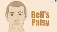 Pfizer COVID-19 Vaccine May Have Caused Four Trial Volunteers to Develop Bell's Palsy! From Symptoms to Common Causes, Know More About Temporary Facial Paralysis