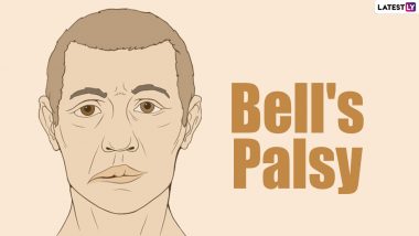 Pfizer COVID-19 Vaccine May Have Caused Four Trial Volunteers to Develop Bell's Palsy! From Symptoms to Common Causes, Know More About Temporary Facial Paralysis