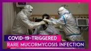 COVID-19-Triggered Rare Mucormycosis Infection: Half The Victims Lost Eyesight At Delhi&rsquo;s Sir Ganga Ram Hospital