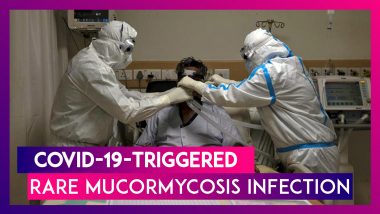 COVID-19-Triggered Rare Mucormycosis Infection: Half The Victims Lost Eyesight At Delhi’s Sir Ganga Ram Hospital