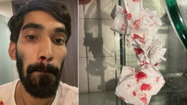 India’s Kidambi Srikanth Left With Bloodied Nose After Multiple COVID-19 Tests in Bangkok