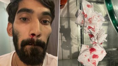 Thailand Open 2021: Kidambi Srikanth Shares Picture of Bloodied Nose After Four COVID-19 Tests, Alleges Poor Treatment From Medical Staff