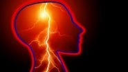 Functional Seizures Associated With Stroke, Psychiatric Disorders, Reveals Study