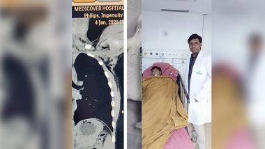 Hyderabad: Doctors Remove Toy Bulb From 9-Year-Old's Lungs