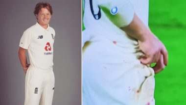 Ollie Pope Injures Himself While Attempting a Catch During IND vs ENG Day-Night Test, England Cricketer Left With Bleeding Right Index Finger