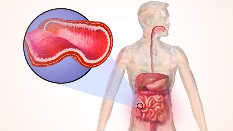 Crohn’s Disease in Children: Novel Potential Therapy for The Inflammatory Bowel Disease Demonstrated By Researchers