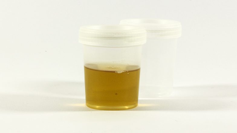 UK Family Drinks Urine For Four Days as Cure to COVID-19 After Watching Fake WhatsApp Video
