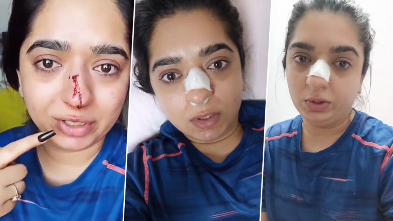 Hitesha Chandranee, Bengaluru Woman Allegedly Assaulted by Zomato Delivery Executive, Leaves Her Bleeding With Broken Nose (Video Goes Viral)