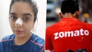 Zomato Delivery Boy Refutes Blame of Bengaluru Woman Hitesha Chandranee, Says &lsquo;She Hit Her Nose With Her Own Ring,&rsquo; Following Viral Video of the Injured Influencer