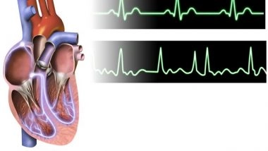 Science News | Smartphone App Detects Silent Atrial Fibrillation in American Indians