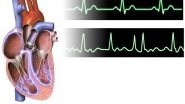 Science News | Study Defines How to Assess Quality of Care for Patients with Atrial Fibrillation