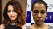 Raiza Wilson&rsquo;s Dermatologist Files a Defamation Case Against the Actress, Demands for Rs 5 Crore Compensation