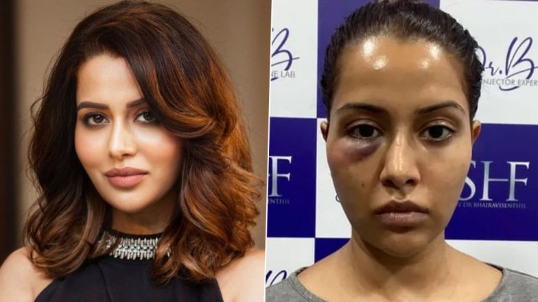 Raiza Wilson’s Dermatologist Files a Defamation Case Against the Actress, Demands for Rs 5 Crore Compensation