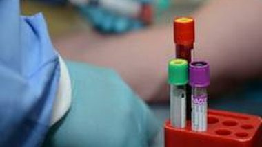 World News | Russian Firm Launches Production of World's 1st Combined HIV, Hepatitis, Syphilis Test