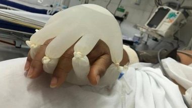 Brazil Nurses Use Gloves Filled with Warm Water to Comfort COVID-19 Patients! Check out the Viral Pic That Is Winning Hearts Online
