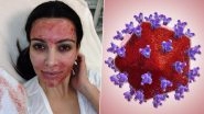 &lsquo;Vampire Facials&rsquo; Popularised by Kim Kardashian: New Mexico Salon Owner Faces 24 Charges After Unsafe Spa Treatment Leaves 2 Customers HIV Positive