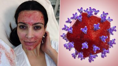 ‘Vampire Facials’ Popularised by Kim Kardashian: New Mexico Salon Owner Faces 24 Charges After Unsafe Spa Treatment Leaves 2 Customers HIV Positive