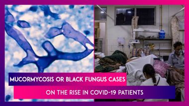 Mucormycosis Or Black Fungus Cases On The Rise In Covid-19 Patients In India