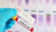 World News | Over 13,000 Coronavirus Variants Detected in Russia, Says Vaccine Developer
