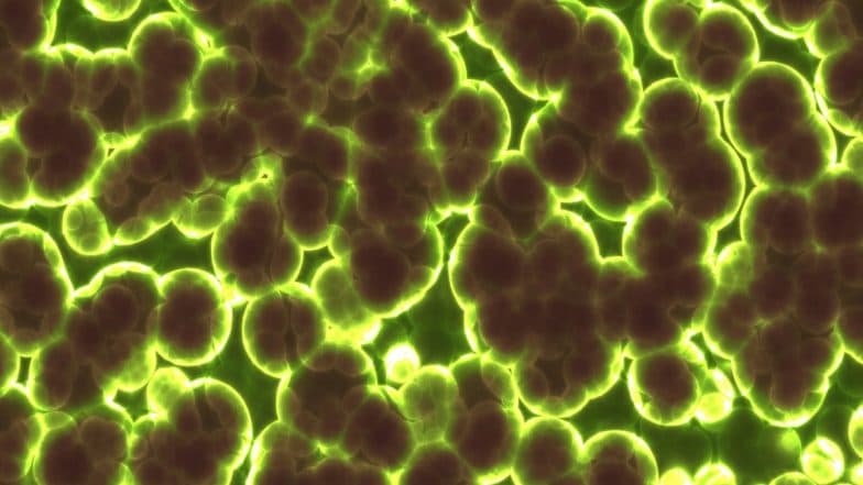 Mucormycosis Re-Infection: 9 Cases of Black Fungus Re-Infection Reported in Agra, All Patients Over 40 Years of Age