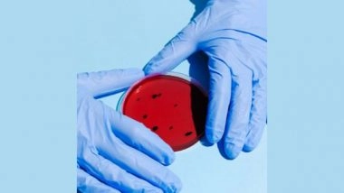 Health News | Bacterium Causing Rabbit Fever Remains Virulent for Months in Cold Water, Finds Study