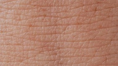 Science News | Enzymes Protect Skin by Ignoring Microbes, Viruses