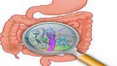 Health News | 'Good' Bacteria Show Promise for Clinical Treatment of Crohn's Disease, Ulcerative Colitis
