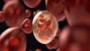 Science News | Piperlongumine Promotes Death of Retinoblastoma Cancer Cells: Study