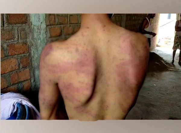 Indore: Oxygen Plant Owner Booked for Severely Thrashing Employees for Selling Cylinders Illegally
