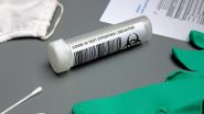 Science News | Study on Harnessing Next Generation Sequencing to Detect SARS-CoV-2
