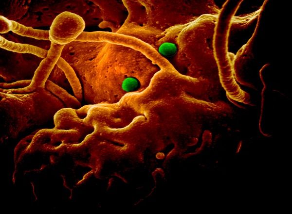 Artificial Intelligence Predicts How Patients Will Fare Against Viral Infections