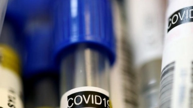 World News | Philippines Logs 6,096 New COVID-19 Cases, Total Rises to 1,397,992