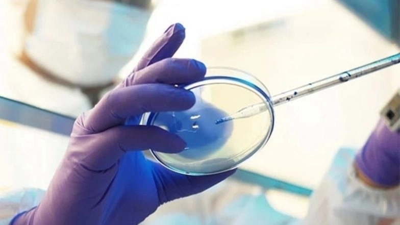 Uncontrolled Diabetes, Improper Steroid Use Major Factors for Black Fungus, Say Doctors